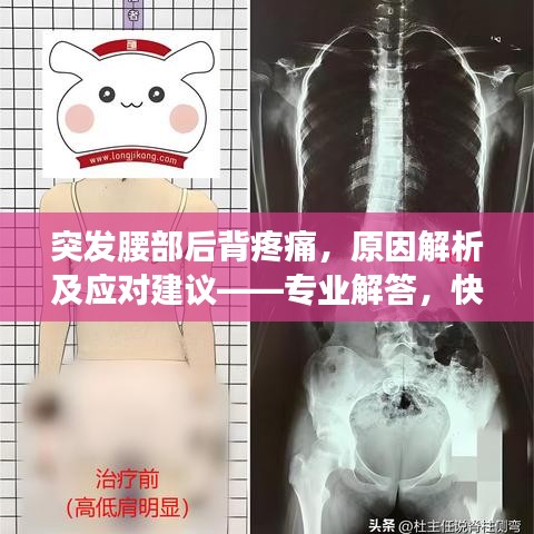 突发腰部后背疼痛，原因解析及应对建议——专业解答，快速缓解病痛