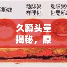 久蹲头晕揭秘，原因解析与应对良方
